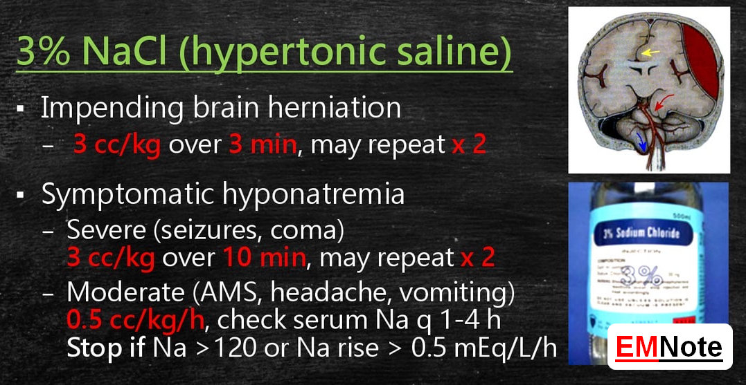 3% NaCl (hypertonic saline) is used to treat severe hyponatremia. youtube.com/watch?v=kAimDa…