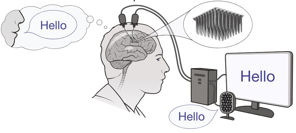 Brain-To-Text Competition 2024

This is the most fascinating BCI competition yet, organized by Stanford. 

Everyone has time to develop the world's best brain-to-speech decoder!

Deadline: June 2, 2024

Task: Predict attempted speech from brain activity.

Dataset: They've