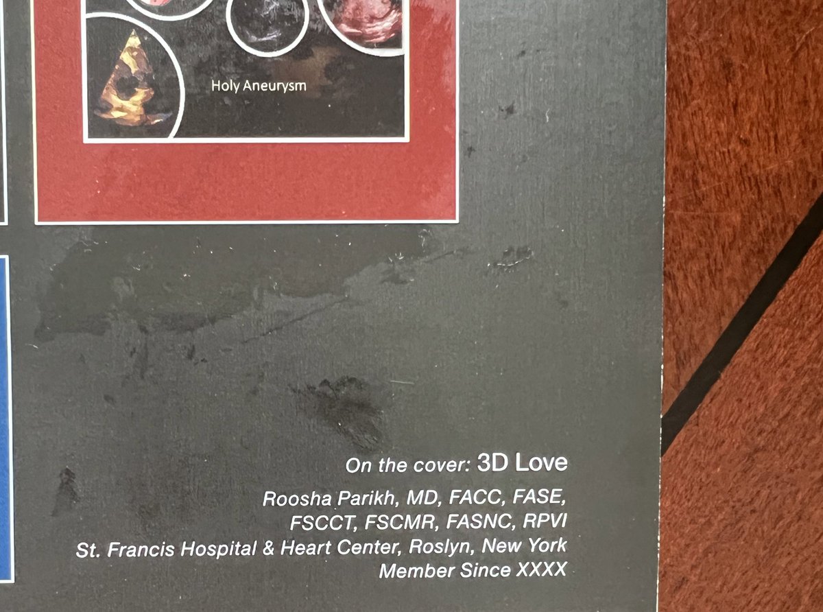 My @StFrancis_LI  3D mitral valve TEE image featured on the cover of @ASE360 2024 Calendar!
#echofirst @e3ASE 

 Learnt from masters of TEE @SLittleMD @WilliamZoghbi @DeBakeyCVedu 

@iamritu @renujain19 @LucySafi @purviparwani @OKhaliqueMD @AkhilNarangMD @patelapurva @ziadalinyc