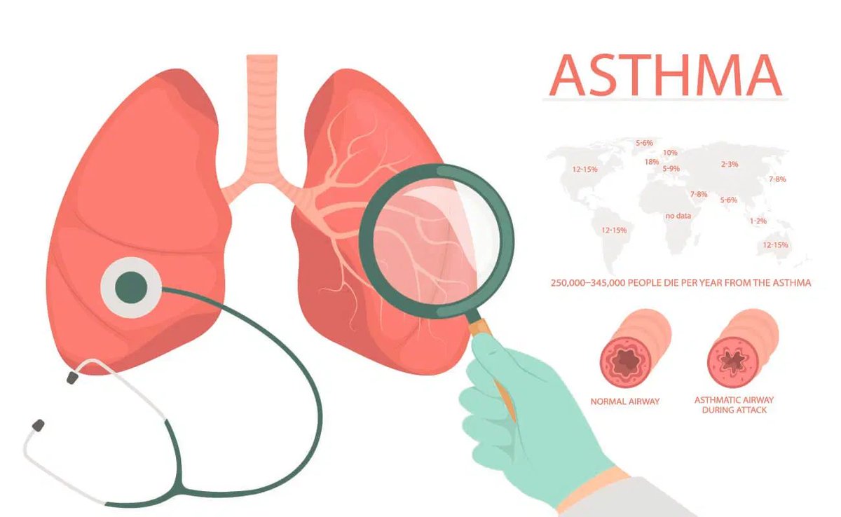 Explore the distinct forms and triggers of asthma. Discover more at #asthmaawareness #healthtips.  buff.ly/3Wb5gES