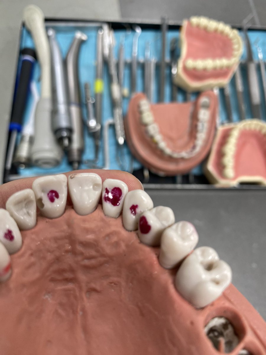 اطول يوم ؟ بلا شكك