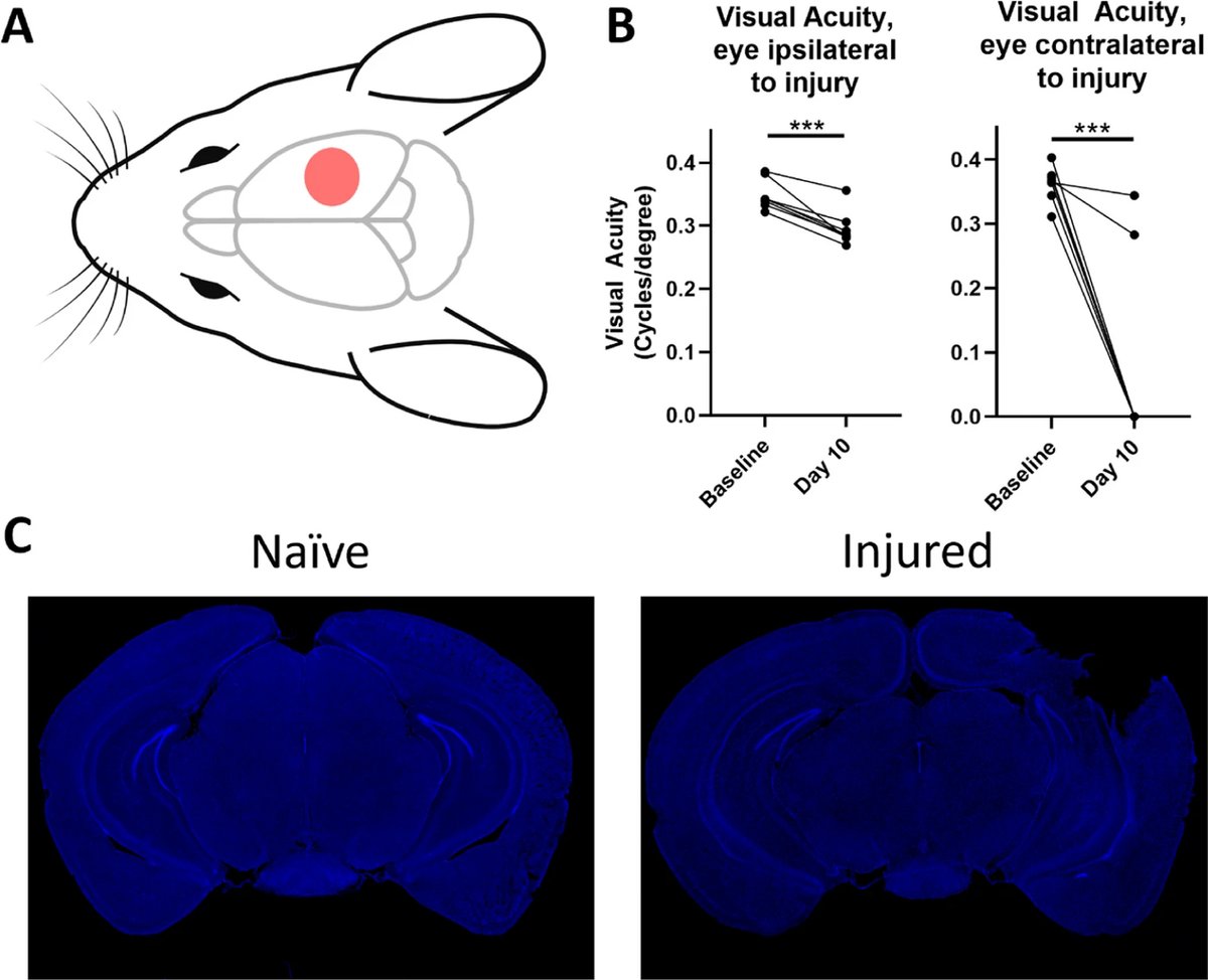 Research at @MedUnivSC: complement plays a role in vision loss following traumatic brain injury (mice). Suggests a way forward for preventing vision deficits from secondary #TBI injury. @Davis_Borucki @MUSC_MI #NEIfunded, published @SpringerNature: bit.ly/3U9Bj5t