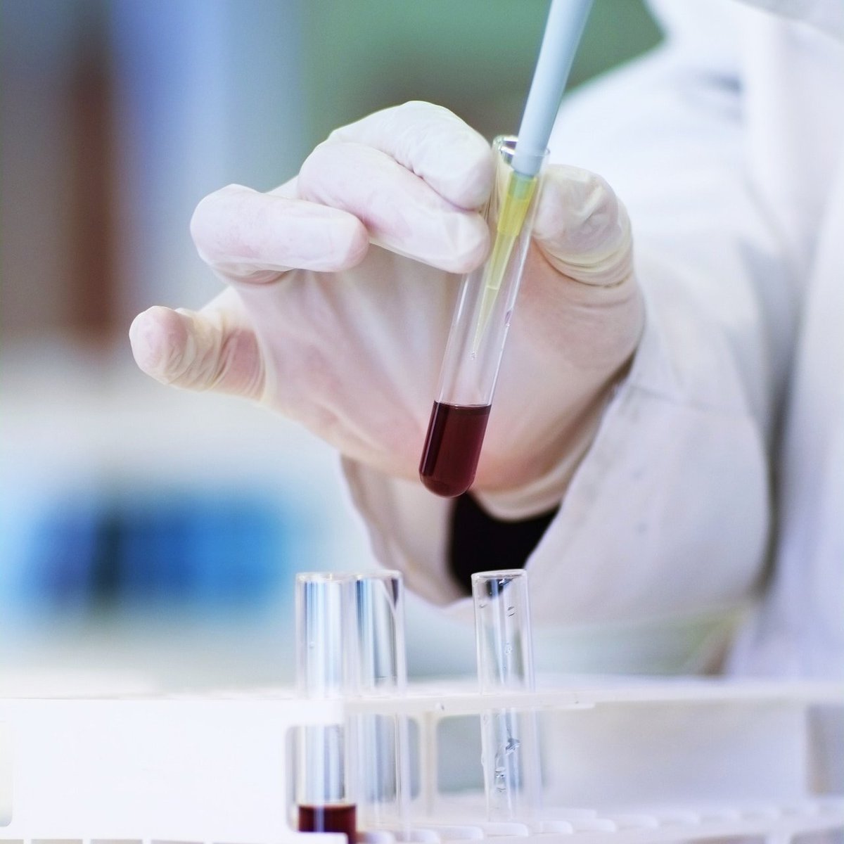 Cambridge Department of Medicine (@medcambridge) on Twitter photo Job Opportunity: Post Doc Research Associate working with <a href="/TianXZhao/">Tian Zhao</a> and <a href="/mallat_lab/">Mallat_Lab</a> identifying the immunological mechanisms underlying atherosclerosis
➡️ jobs.cam.ac.uk/job/45969/
Closes: 28 April 2024
#postdoc | #jobs | #research | <a href="/HLRI_Cambridge/">VPD Heart & Lung Research Institute</a> | <a href="/Cambridge_Uni/">Cambridge University</a> Job Opportunity: Post Doc Research Associate working with <a href="/TianXZhao/">Tian Zhao</a> and <a href="/mallat_lab/">Mallat_Lab</a> identifying the immunological mechanisms underlying atherosclerosis
➡️ jobs.cam.ac.uk/job/45969/
Closes: 28 April 2024
#postdoc | #jobs | #research | <a href="/HLRI_Cambridge/">VPD Heart & Lung Research Institute</a> | <a href="/Cambridge_Uni/">Cambridge University</a>