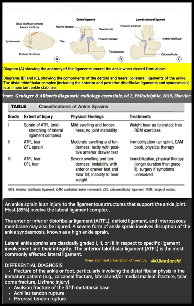 The anatomy of the ligaments around the ankle when viewed from above as well as the components of the deltoid & lateral collateral ligaments of the ankle illustrated👍Brief description of ankle sprain and its classifications also mentioned.