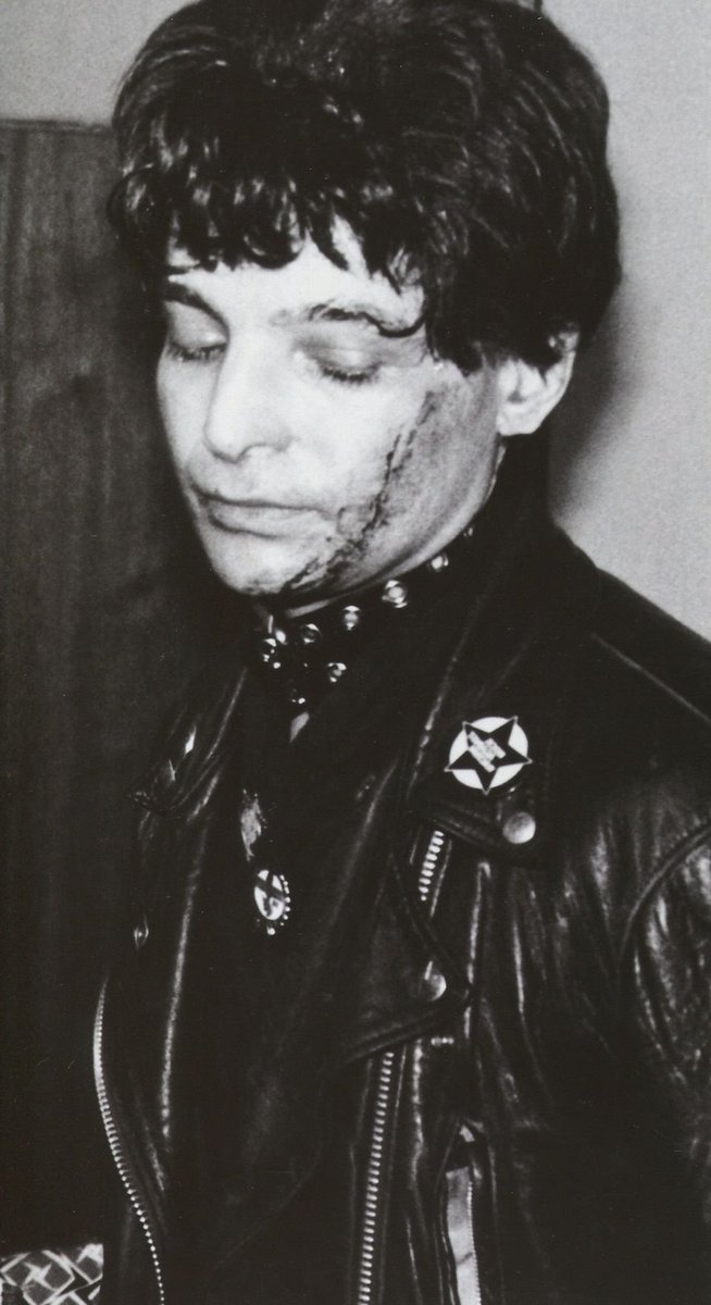 Alan Vega on supporting The Clash in 1978...'I got my nose busted in Crawley...In Glasgow someone threw an axe by my head! ...In Plymouth The Nazis...got me in the dressing room'