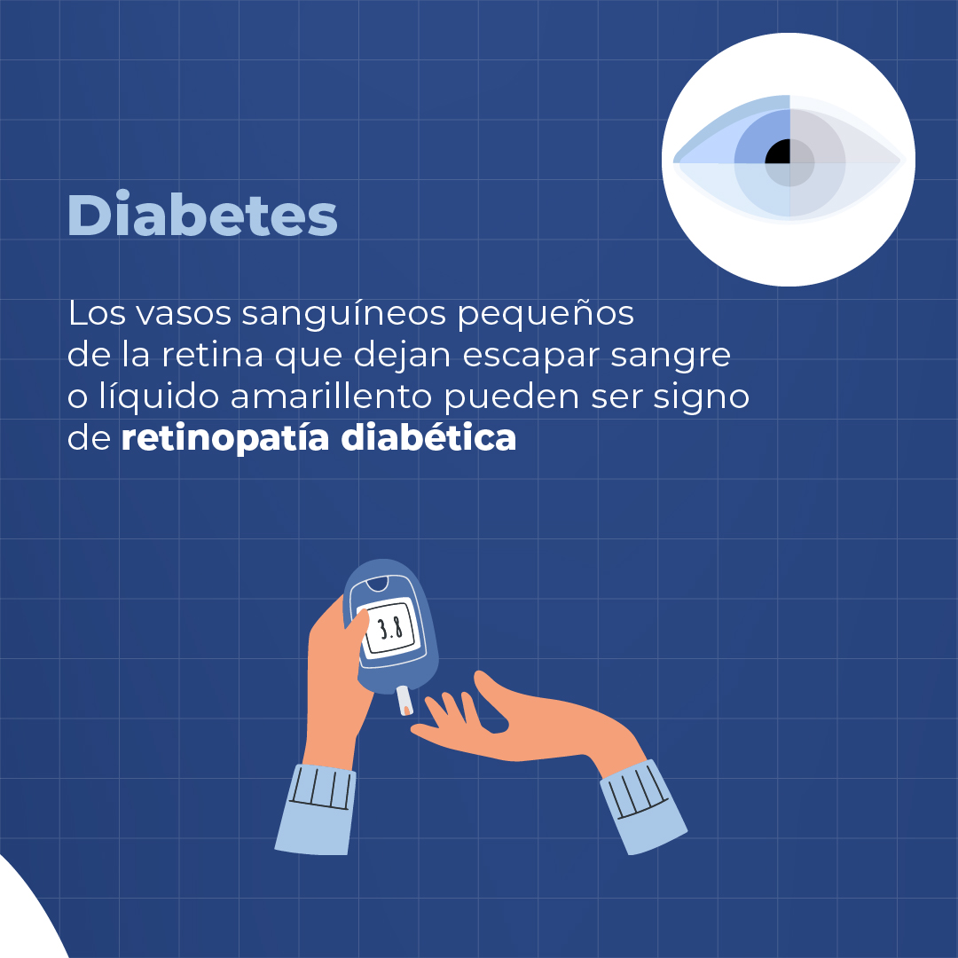 HospitalApec's tweet photo. ¡Un CheckUp Oftalmológico puede mejorar tu salud general! No esperes más y agenda tu cita hoy mismo #ExamenVisual #Diabetes #APEC #SaludVisual https://t.co/O9WLFvYzd1
