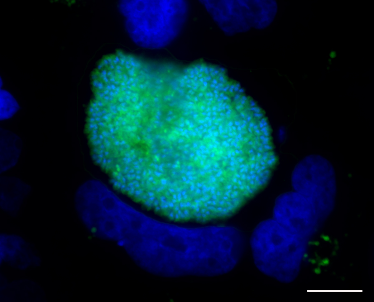 Plasmodium is notorious for growing in the blood and causing #malaria, but the liver stage of growth is essential for the parasites to establish infection. One Plasmodium sporozoite can take over a host hepatocyte and generate thousands of progeny. #infectneXt