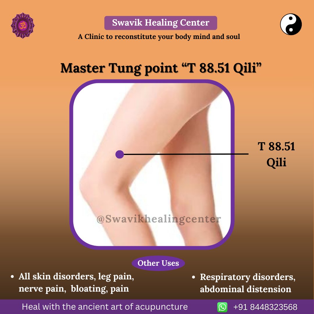 ☯ Master Tung point “T 88.51 Qili”
☯ Bloating is a condition where your belly feels full and tight, often due to gas.

#acupunctureclinic #acupressurepoints #cuppingmassage #cuppingmassagetherapy #bloating #nervepain #legpainrelief #respiratory #respiratoryhealth #abdominal