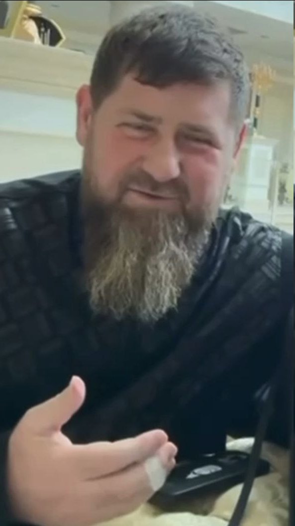 Sind Ärzte anwesend?
Was ist denn Pankreasnekrose?
Kadyrow soll sowas haben.
