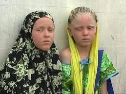 Here are some pictures of albino Somali children. Your entire concept of race is inconsistent garbage
