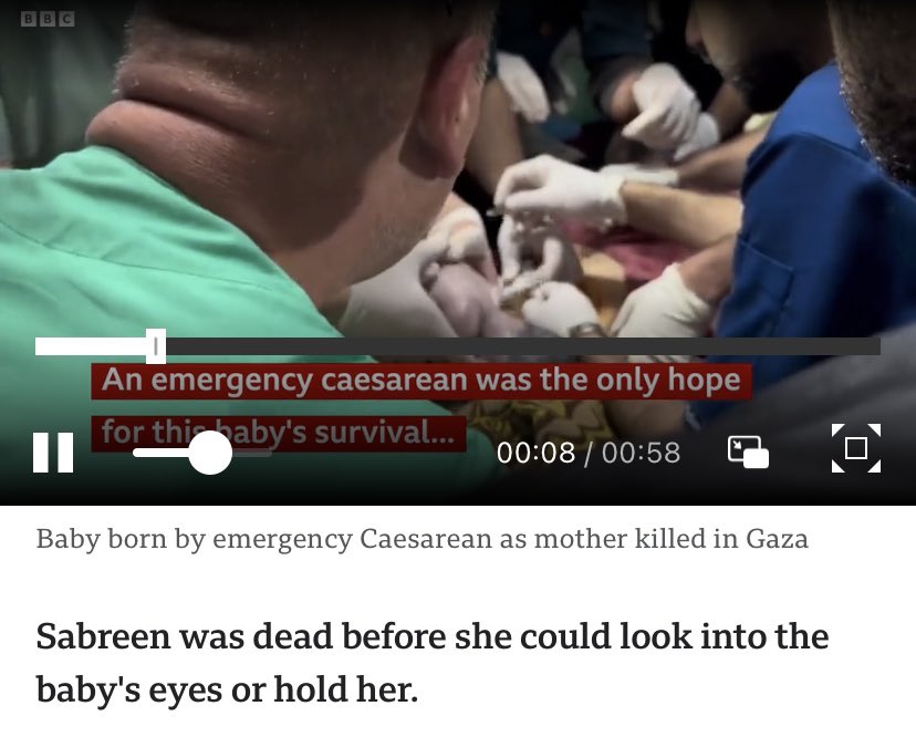 Baby saved from dead mother’s womb after Israeli strike 💔💔😢
#PalestineFree #PalestineLivesMatter