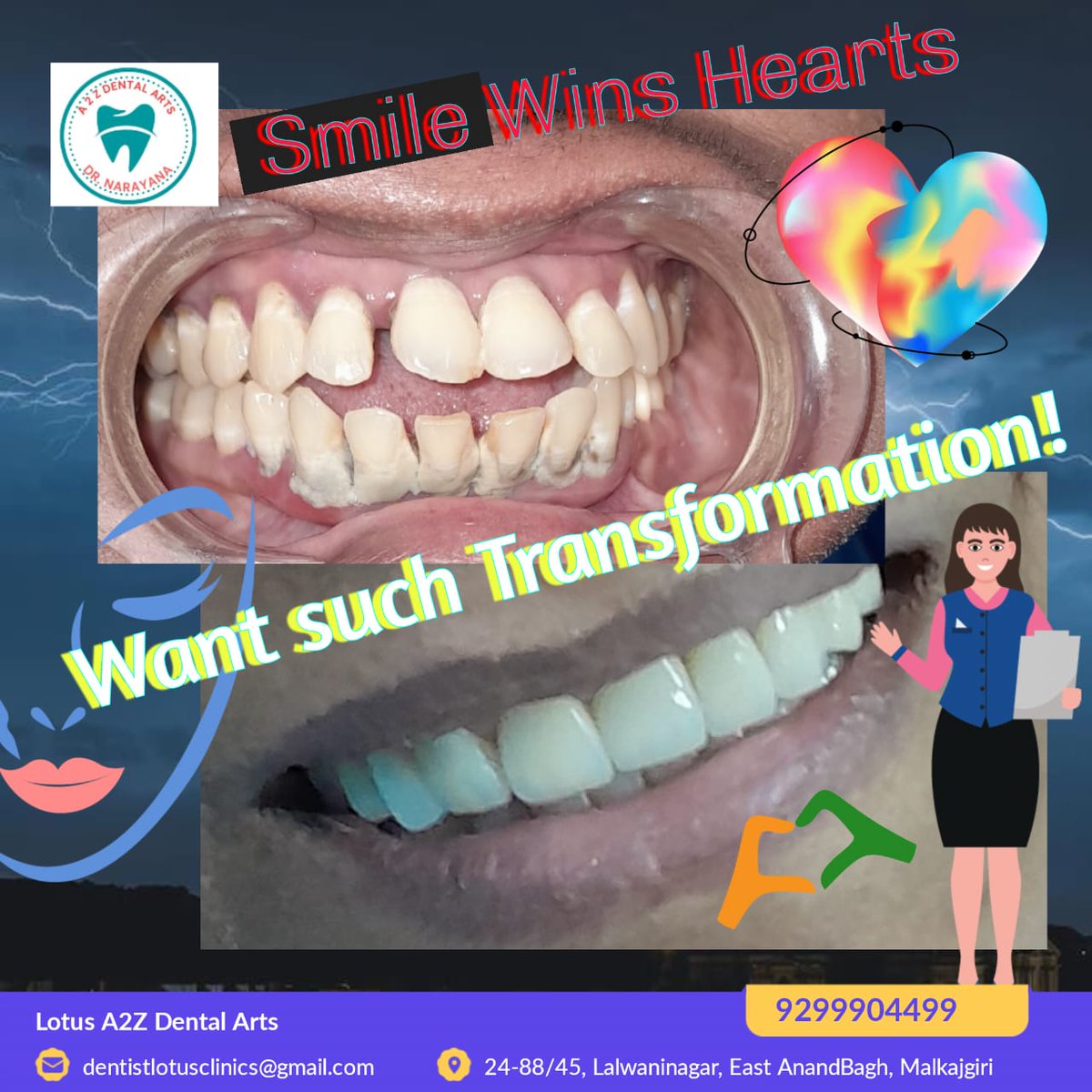 Best dental hospital in hyderabad #Anandbagh #Malkajgiri #secunderabad #Secunderabadmetro #Hyderabad #Tarnaka #malkajgirimla #MALKAJGIRIMP #dentalimplants #dentalclinic #wisdomteeth #wisdomteethremoval #snoring #dental #dentist #trending #rct #rootcanalretreatment #rootcanals