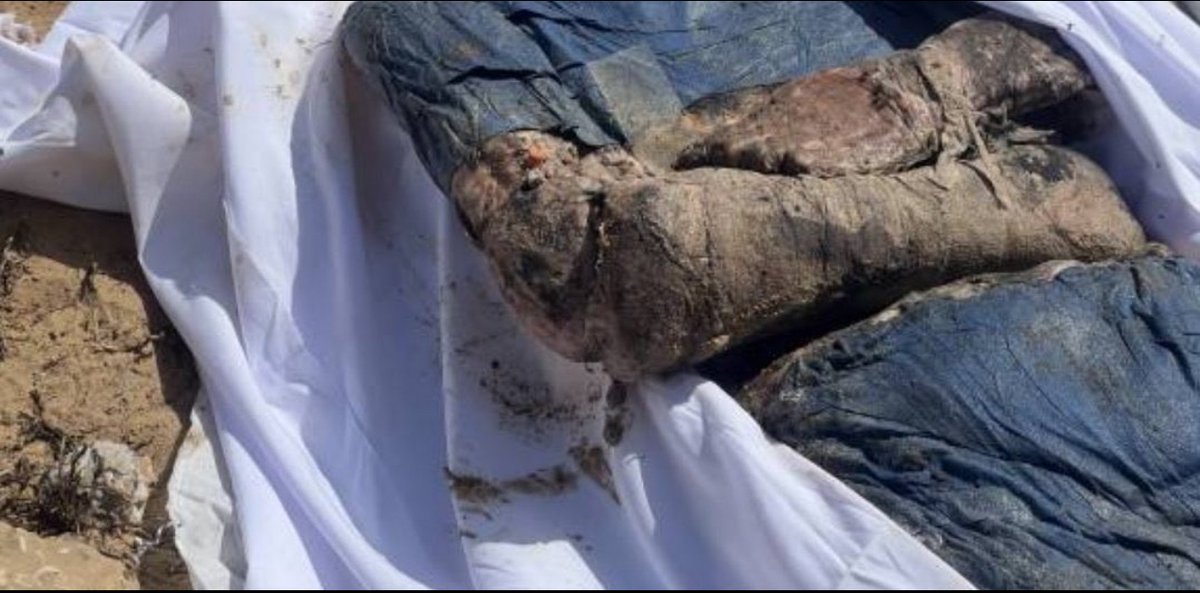 This person's body exhumed at the Nassar Hospital massacre had their hands tied and is wearing scrubs. Clear evidence that the IOF executed hospital personnel, just like at Al-Shifa Hospital.