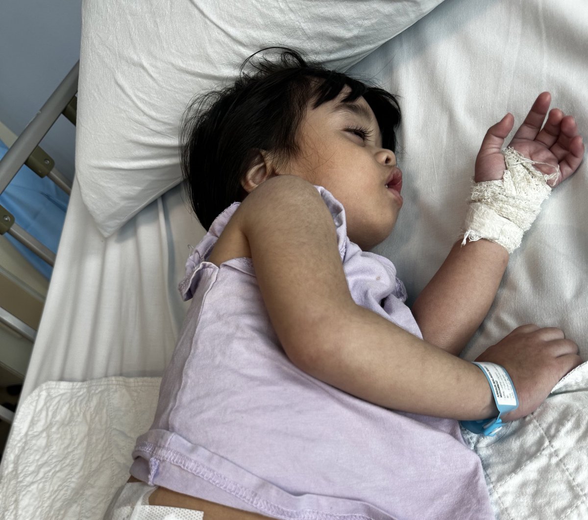 anaihhhsaid's tweet photo. Anak aku duduk taska start dari umur 1 tahun lebih, selang 1-2minggu mesti start taksihat, batuk2 demam sbb berjangkit dari kawan2.

Ni masa raya haji tahun lepas,lepas 3hari demam on off suddenly demam nya spike and kena sawan. Sumpah kelam kabut time tuu https://t.co/iwnbBdO05L