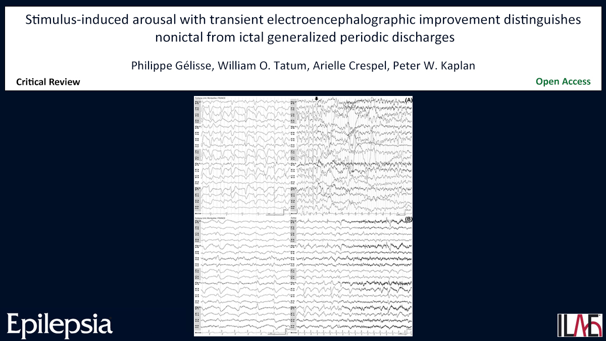 Epilepsia (@epilepsiajourn) on Twitter photo Key point: Toxic/metabolic encephalopathies can sometimes be mistaken for NCSE.
doi.org/10.1111/epi.17…
#ICU #statusepilepticus #reactivity #stimulation #triphasicwaves #EEG #epilepsy #ILAE <a href="/IlaeWeb/">International League Against Epilepsy</a> <a href="/epilepsiajourn/">Epilepsia</a> <a href="/WileyNeuro/">Wiley Neuro</a> Key point: Toxic/metabolic encephalopathies can sometimes be mistaken for NCSE.
doi.org/10.1111/epi.17…
#ICU #statusepilepticus #reactivity #stimulation #triphasicwaves #EEG #epilepsy #ILAE <a href="/IlaeWeb/">International League Against Epilepsy</a> <a href="/epilepsiajourn/">Epilepsia</a> <a href="/WileyNeuro/">Wiley Neuro</a>