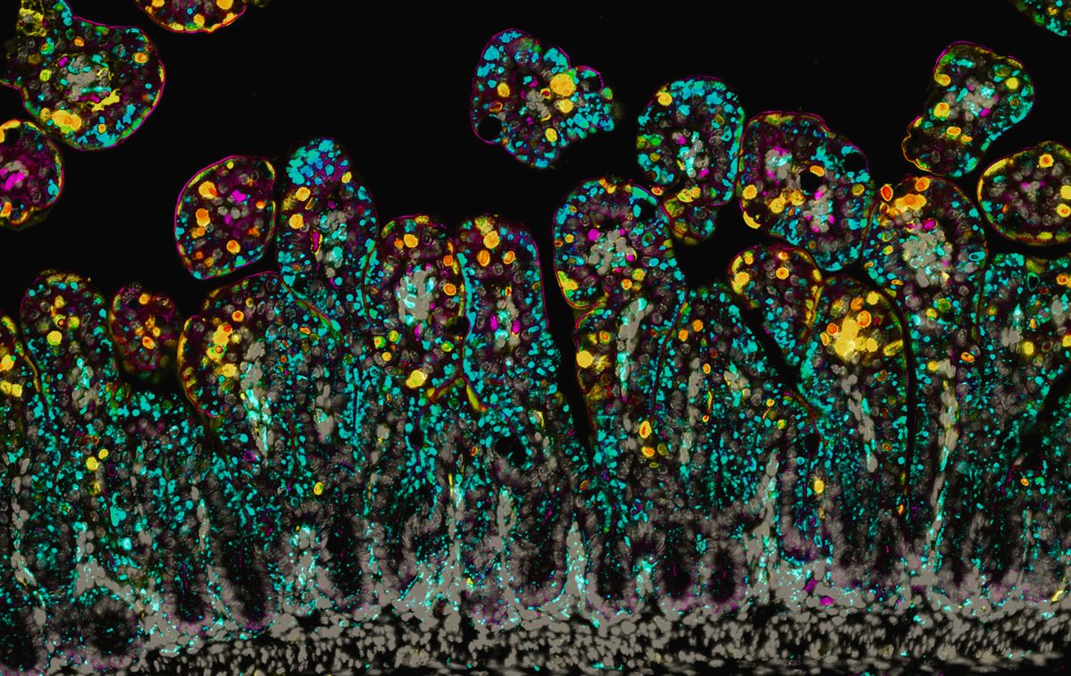 Some very confused intestinal cells for #MicroscopyMonday. Also seems appropriate since I am attending #Pathobiology2024 and learning so much. 

#bioart #sciart #microscopy #pathart #histoart #intestine