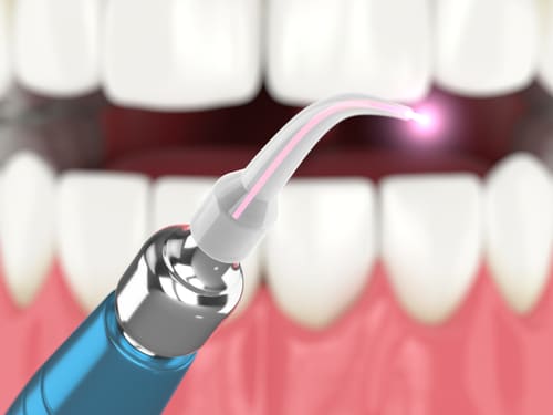 In this video, Dr. Amelia Aristodemo explains the different methods of gum disease treatment, such as deep cleaning and laser therapy.  #schaumburg #dentist #happysmiles bit.ly/3w71rWz