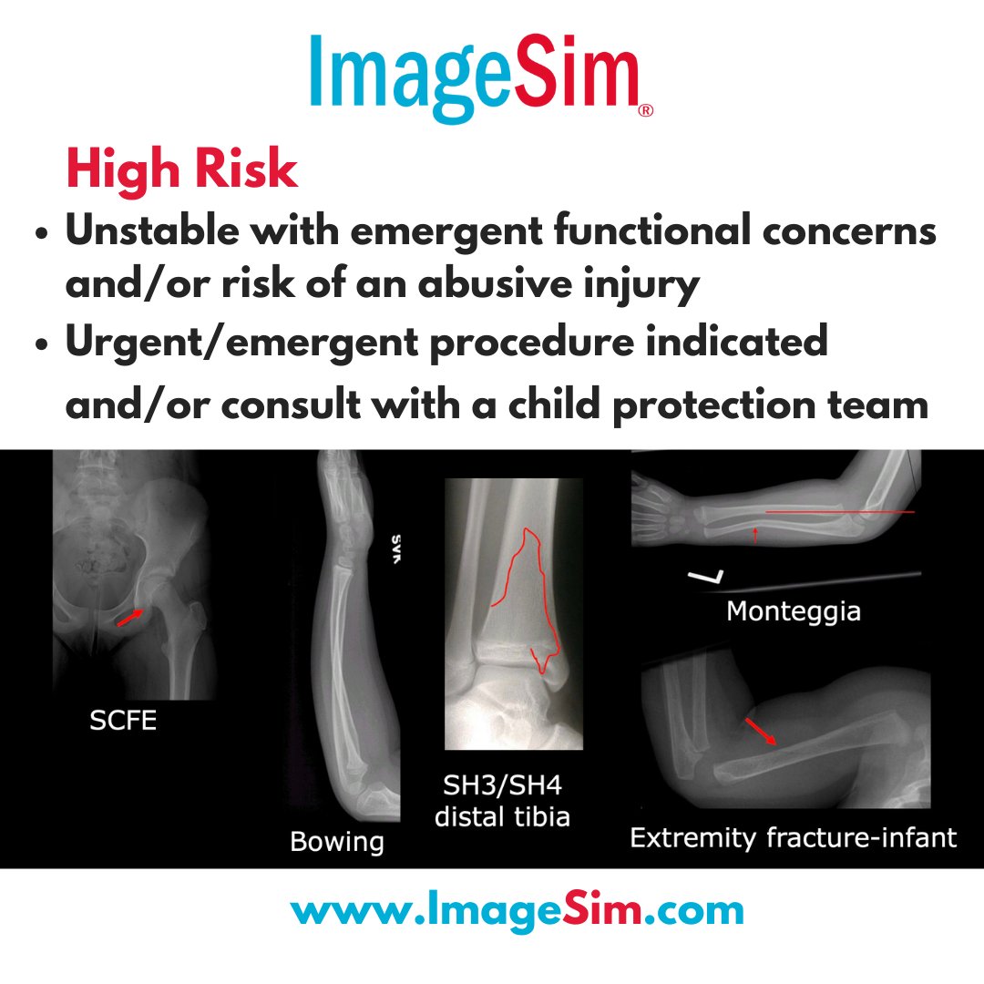 🌐ImageSim.com

Check out the following link for ImageSim Pediatric Musculoskeletal Fracture Diagnosis and Management Course:

lnkd.in/eSi2MrXp

#ImageSim #cme #healthcare #healthcaresystem #medicalcourses #medicaltips #msk #Pediatric #Fractures #sickkids #uoft