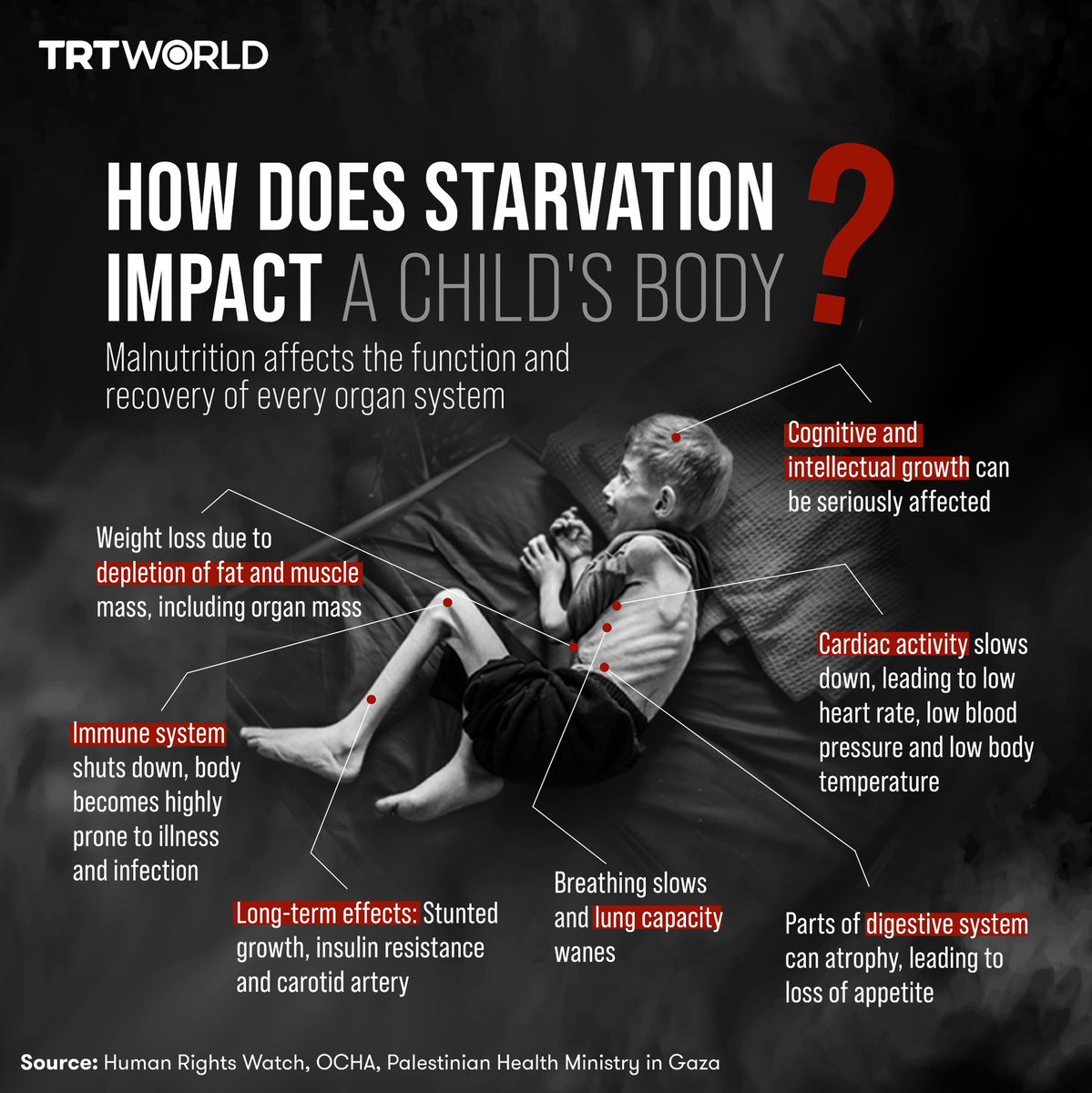 ‼️ At least 28 children have died of malnutrition and dehydration since Israel’s onslaught began and as of April 19, Gaza’s health ministry reported.

Hundreds of thousands more could face starvation as Israel continues to “use starvation as a weapon of war” in Gaza, where 70% of