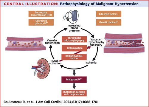 🔴 Malignant Hypertension:A Systemic Cardiovascular Disease <a href="/JACCJournals/">JACC Journals</a> #CardioEd #Cardiology #MedEd #ENARM