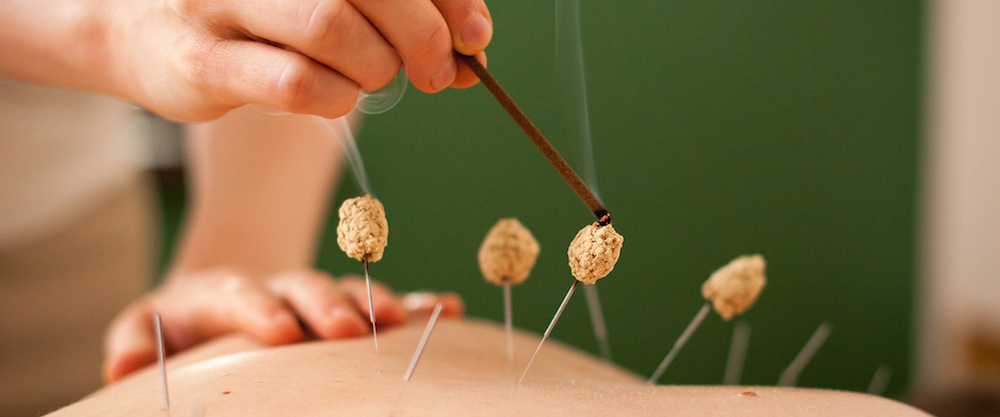 Are you looking for the Best #Moxibustion in #JurongWest? Then contact them at #GOWTCMHealthcare, your premier destination for Traditional Chinese Medicine (TCM) services with over 20 years of experience.

Visit -maps.app.goo.gl/vqgVo4He848SMC…