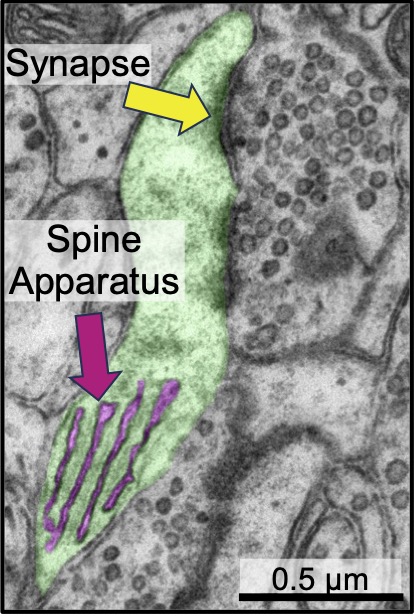 This #EM_Monday I share a🧵on our new paper @PDCLab. Whether you are into organelles, cytoskeleton, neurons, or just enjoy a fun story, this is for you! Organelles like ER in specialized cells can take weird shapes, w/ the spine apparatus(SA) of dendrites as a prime example (1/n)