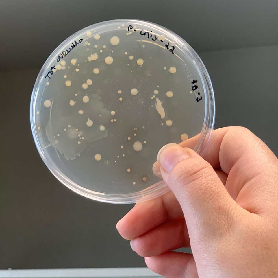 MicroMundo_IUCS's tweet image. 👏On this Earth Day, we had the 3rd session of MicroMundo where we observed the cultural growth of our soils - we performed antibiosis assay and are looking forward to the results! 🦠
@Cespu_Ensino @TOXRUNIUCS