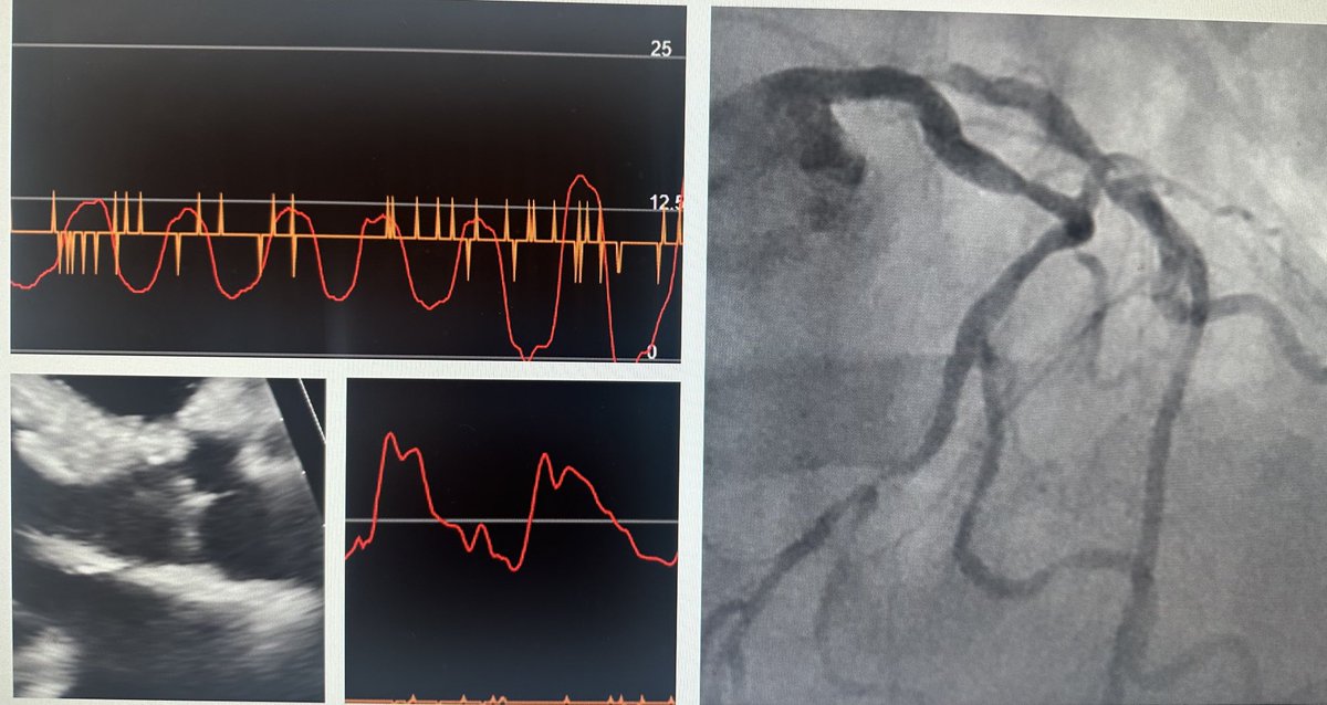 Today’s menu: Four cases and four different indications for surgery. Identify the diseases and reasons for surgery.