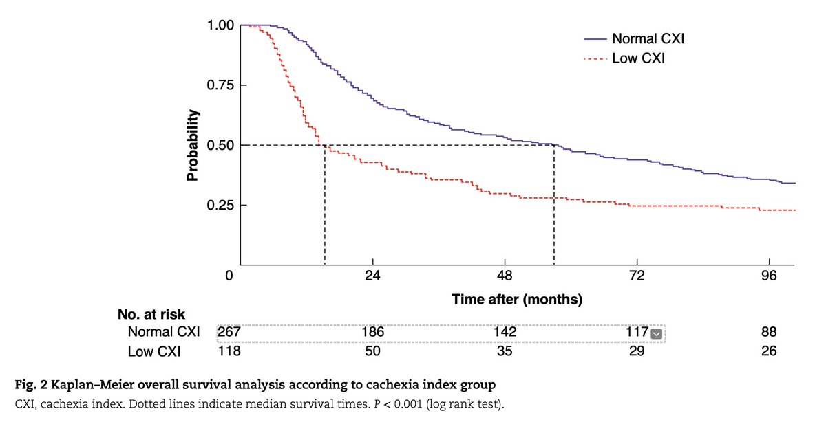 Cachexia index for prognostication in surgical patients with locally advanced #oesophageal or #gastriccancer: multicentre cohort study ➡️ doi.org/10.1093/bjs/zn… Cachexia index represents a valuable marker of ‘host stage’, and a potential adjunct to routine tumour staging. This