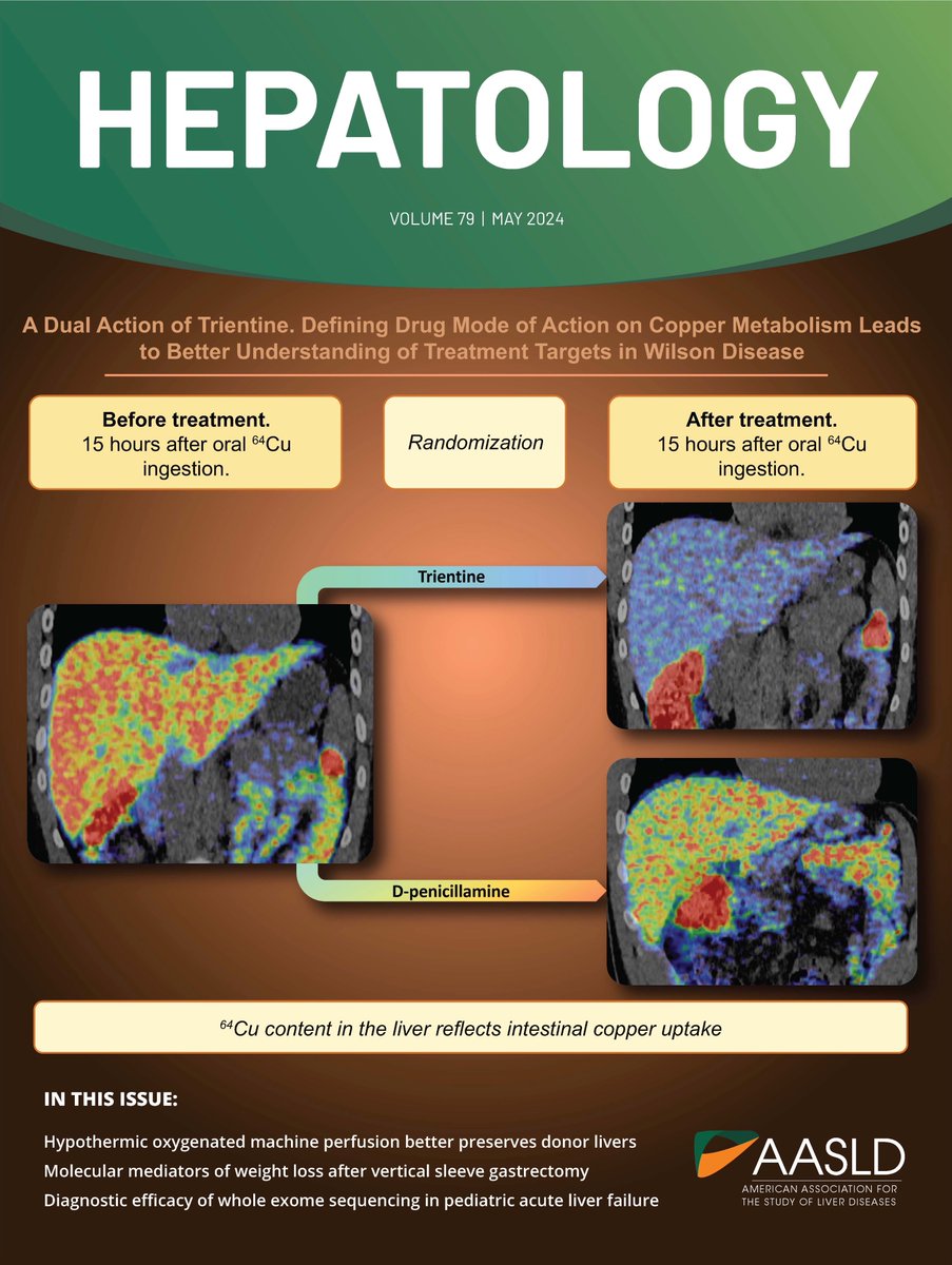 ForskerFrede's tweet photo. @HEP_Journal front page May 2024.
#WilsonDisease #LiverTwitter #raredisease 

@HepGas @AarhusUni @AUHdk 

PET/CT images from our most recent publication:
#OA https://t.co/V4qoEJDJqg https://t.co/iMcEBxVaSe