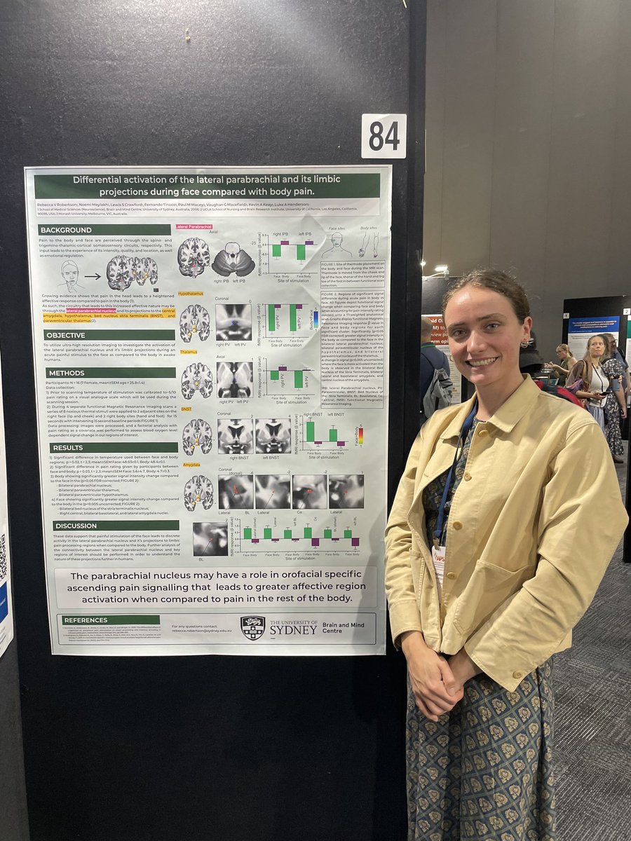 Another rep from the Henderson Lab! Poster board 84, check out @rvrrobertson <a href="/AusPainSoc/">Australian Pain Soc</a> #AusPainSoc
