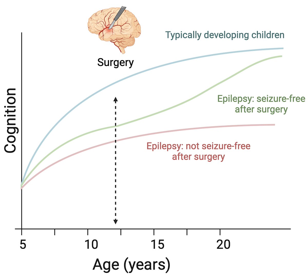 In a retrospective study, Eriksson et al. show that epilepsy surgery was able to halt and even reverse a decline in neuropsychological functioning in certain children by providing seizure freedom and the opportunity to discontinue antiseizure medication. tinyurl.com/2s3wu9u6
