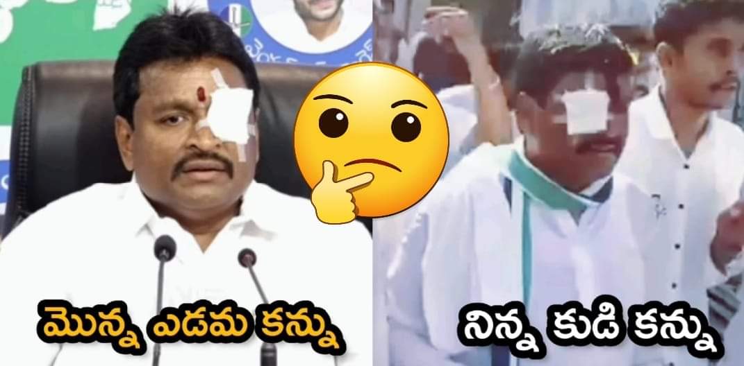 ఇది సామాజిక మాధ్యమాలలో చాలా విసృతంగా వైరల్ అవుతున్న ఫోటో. మొదట నేను దీనిని ఫోటో మార్ఫింగ్ అని భావించాను. తరువాత మిర్రర్ ఇమెజ్ లాంటిదిగా భావించాను. కానీ తరచి తరచి చూసాక, కోన్ని సందేహలు కలుగుతున్నాయి. అవేమిటంటే...... 1) తల దువ్వుకున్న విధానం, పాపిడి తీసిన విధానం రెండు ఫోటోలలో