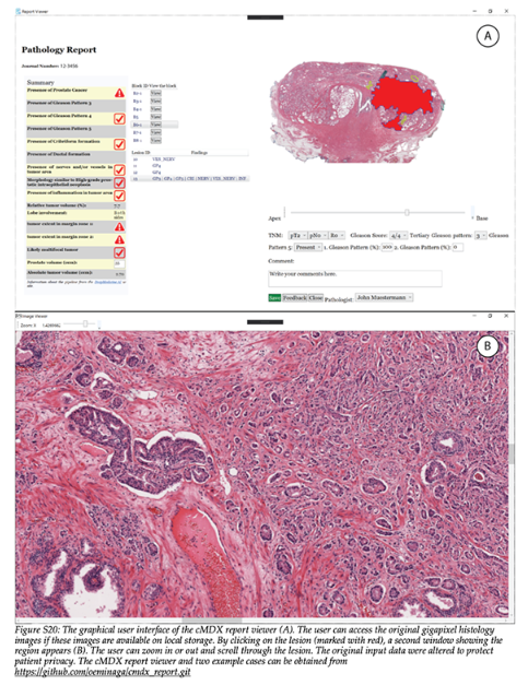 Critical evaluation of #ArtificialIntelligence as a digital twin of pathologists for #ProstateCancer pathology. #BeyondTheAbstract @OkyazEminaga @aivobis provides an insights review into the potential of #AI on UroToday > bit.ly/3ITUmeG @SciReports