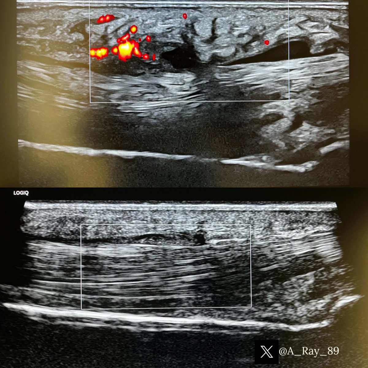 Aaron Ray tweet media