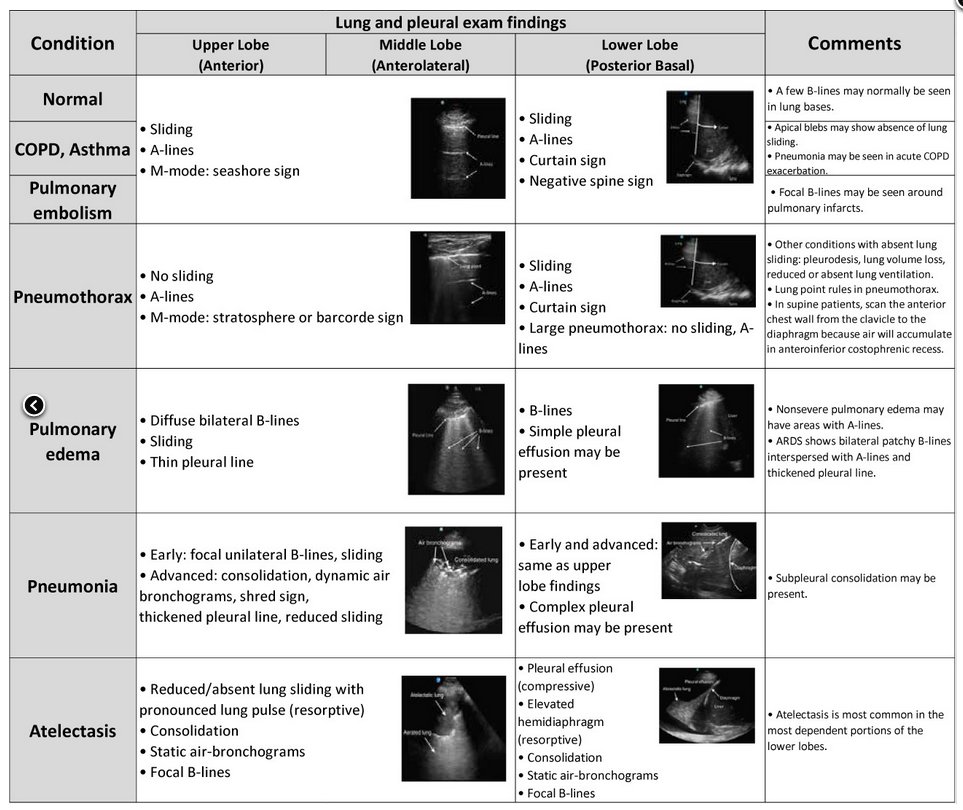 Overview of artificial intelligence in point-of-care ultrasound. New horizons for respiratory system diagnoses CCR Journal Watch criticalcarereviews.com/latest-evidenc… Get the latest critical care literature every weekend via the CCR Newsletter - subscribe at criticalcarereviews.com/newsletters/su…