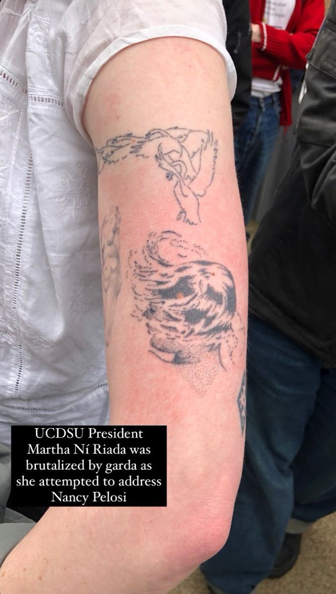 The two individuals who forcibly removed me from the room, unlawfully without any verbal warning, were @gardainfo, supported by UCD security. The images below are of my arms after the event. Disturbing for this to occur at a @ucddublin event, student safety clearly not a concern.