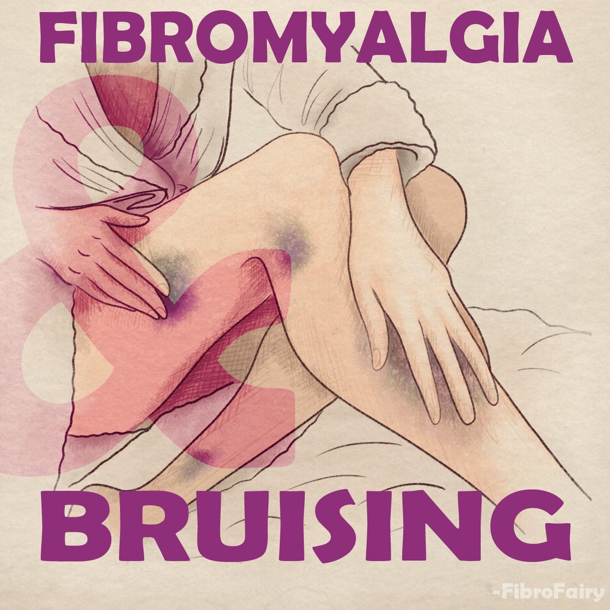 Did you know over 50% of us with #Fibromyalgia experience skin issues, like easy bruising?
It might be from unnoticed bumps due to #fibrofog or nutritional deficiencies, like low #VitaminC, which weakens blood vessels.
It's worth checking your values to rule out any issues!