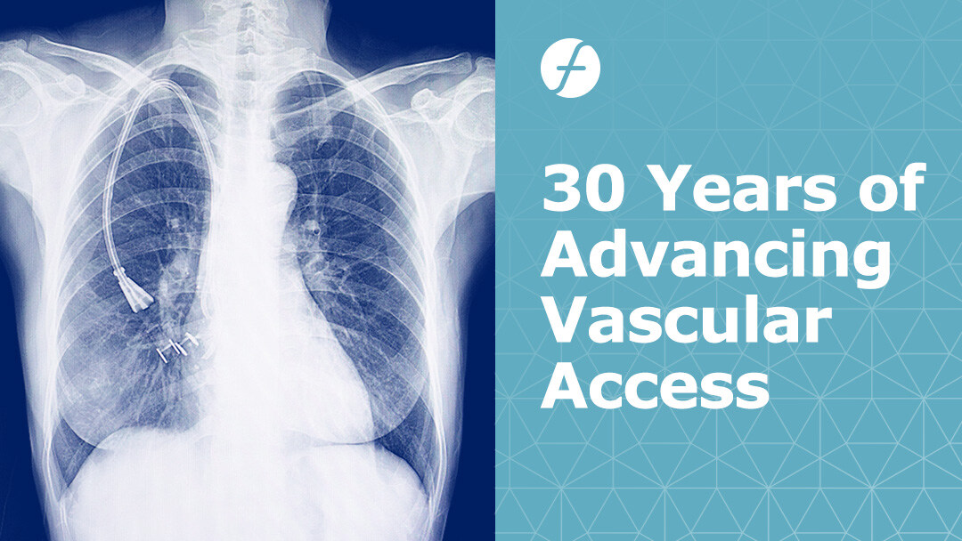 🏥 Flexan has helped OEMs develop cutting-edge catheters that have had a profound influence on patient outcomes and empower safe, dependable, and efficient vascular access. 

Choose the best in catheter manufacturing: hubs.li/Q02tJs_x0 #vascularaccess