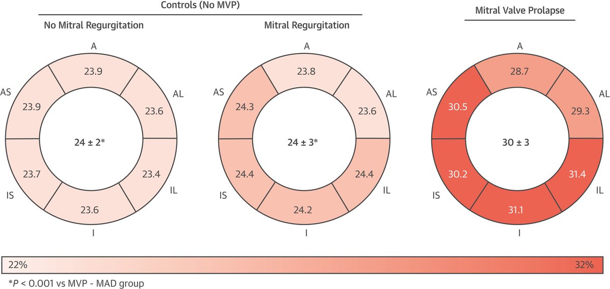 🔴 Mitral Annular Disjunction in the Context of Mitral Valve Prolapse: Identifying the At-Risk Patient : State-of-the-Art #2024Review #OpenAccess

sciencedirect.com/science/articl…
#ECG #EKG #FOAMed #MedEd #medstudent #paramedic #Cardiology #CardioEd #medtwitter #meded #CardioTwitter