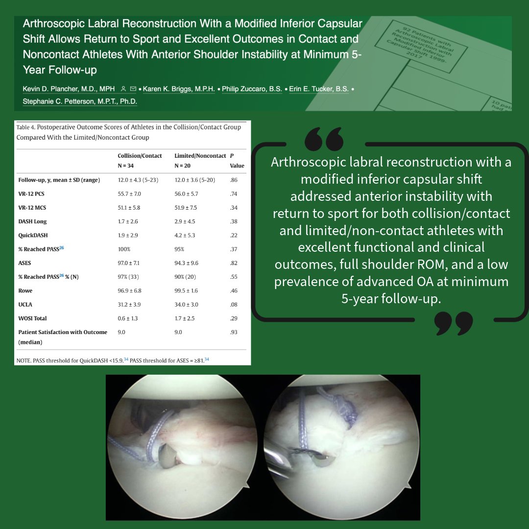 Arthroscopic Labral Reconstruction With a Modified Inferior Capsular Shift Allows Return to Sport and Excellent Outcomes in Contact and Noncontact Athletes With Anterior Shoulder Instability at Minimum 5-Year Follow-up #Shoulderinstability #Labrum ow.ly/ezUa50RrtbP