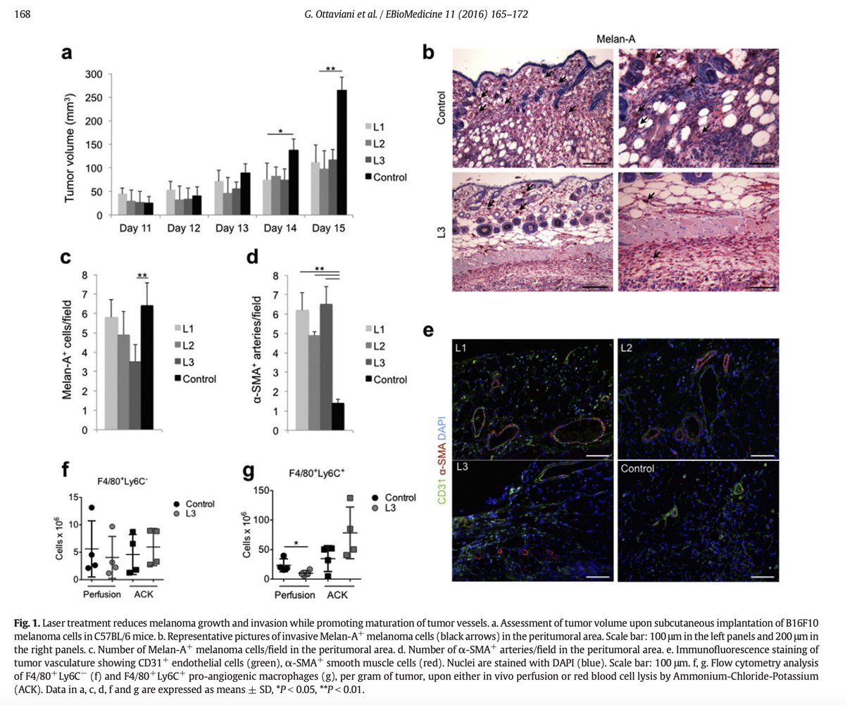 Light stop skin cancer.

Just shining red, near infrared or infrared light (all found in sunlight) on melanoma tumors for 1 minute per day

significantly halted tumor progression 

by:

• Improving cancer immunity
• Restoring energy production

More to the story than UV...