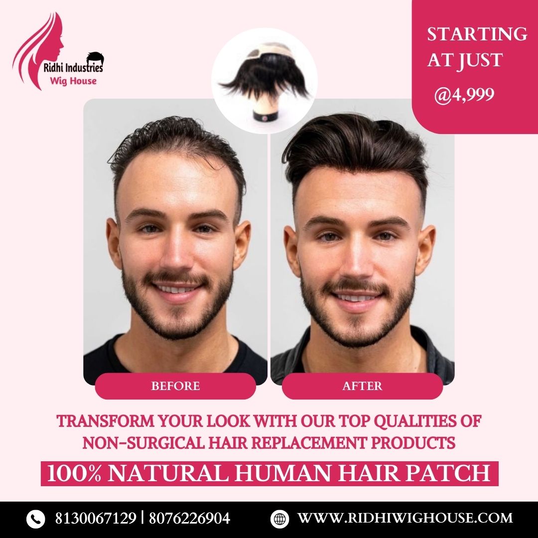 Unlock Your True Potential with Effortless Elegance: Transform Your Look with Our Non-Surgical Hair Replacement Products
#hairwigsatwholesaleprices #hair #bestseller #wigs #hairwigs #humanhairwigs #wholesaler #besthairwigs #naturalhairproducts #nonsurgicalhairreplacement