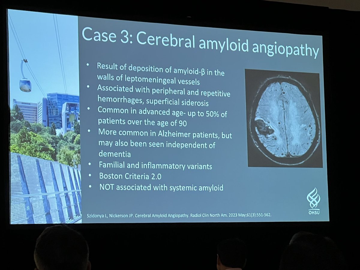 Rapid fire Brain cases from @neurokinghippo at #ARRS24