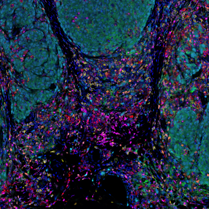 For today's #TissueTuesday, we're sharing a human melanoma FFPE tissue stained w/ a 6-plex MOTiF PD-1/PD-L1 panel auto #melanoma kit & imaged on #PhenoImagerHT.

Learn about our kits crucial for melanoma samples in translational #immunooncology research. bit.ly/3wdqHuc