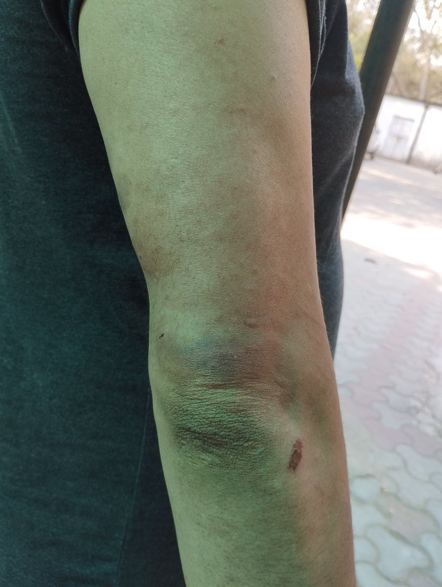 Ritu963852741's tweet image. 