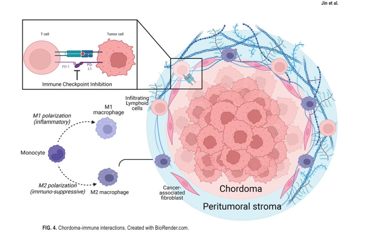 Interested in learning more about the molecular tumorigenesis of chordoma and treatment response? Check out our paper in the lastest @TheJNS Neurosurgical Focus issue on #chordoma. Thank you issue editors and JNS for accepting & highlighting our work, led by @michael_c_jin…