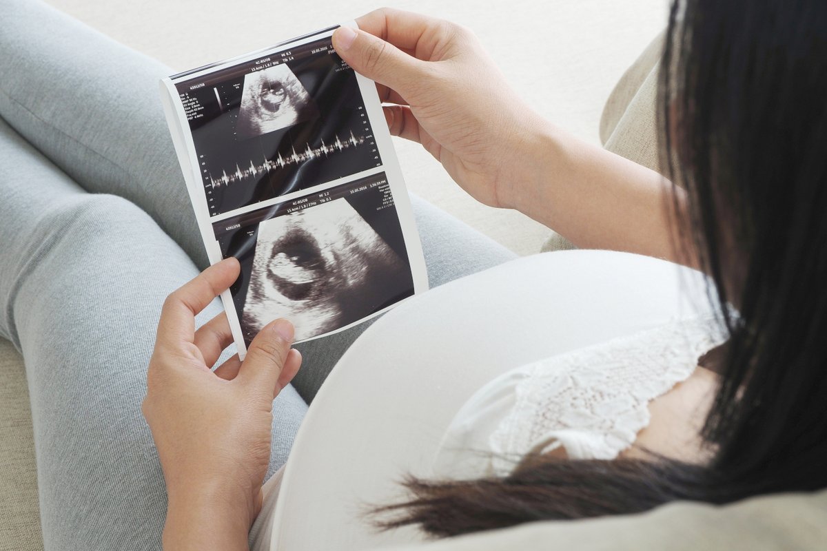 #Recherche 🤰//Des chercheurs @Inserm et @UGrenobleAlpes ont exploré l'impact de la #pollution de l'air sur la #grossesse. Leur étude révèle que l'exposition à certains polluants altère l'#ADN du placenta, pouvant affecter le développement du fœtus. 🔗bit.ly/44Ehbgv