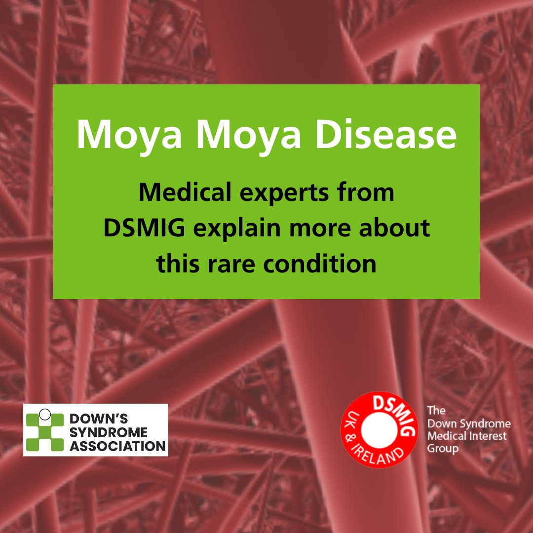 MOYA MOYA DISEASE We are highlighting this rare condition as a result of a parent contacting the DSA about her experience of her daughter receiving a diagnosis. Our Medical Advisers from @DsmigUKIreland explain more here: loom.ly/3S11d48