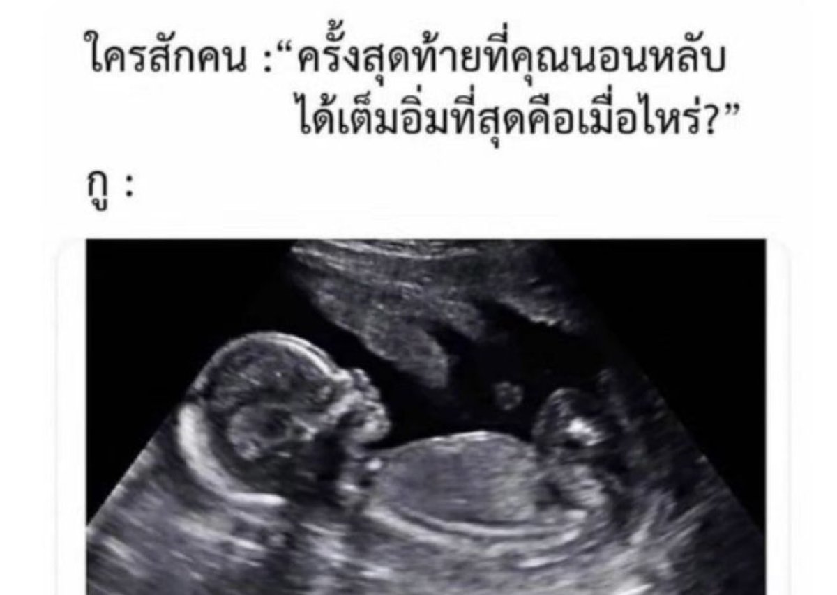 sfkkfs_'s tweet image. ความจริง 5000%